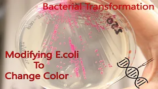 Genetically modifying Bacteria to Change Color - Bacterial Transformation [E.coli - BL-21]