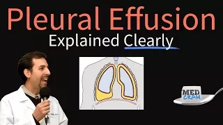 Pleural Effusion Explained Clearly - Causes, Pathophysiology, Symptoms, Treatment,
