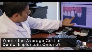 The Average Cost of Dental Implants in Ontario