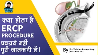 What is ERCP Procedure ? || ERCP Procedure in hindi