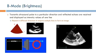 Short Topics in Ultrasound Imaging: Basic Imaging Modes (Arabic Narration)