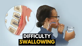Struggling to Swallow? Understanding the Causes and Solutions