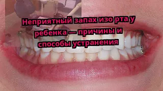 Неприятный запах изо рта у ребенка — причины и способы устранения