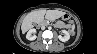 Anatomy of CT scans: Abdomen