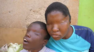 Siblings Born Without Eyes Shocked Everyone | EXTRAORDINARY PEOPLE