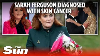 Sarah Ferguson diagnosed with aggressive skin cancer just six months after breast op