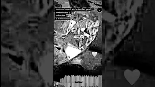 kidsnorlax - shattered myself w/ cholorofilm *prod. xxxtentacion* [snippet]