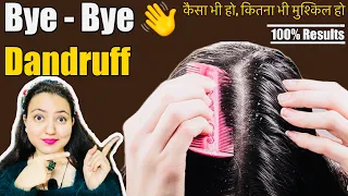 बालों का झड़ना, डैंड्रफ और खुजली को दूर करें in 1st Wash, Remove Dandruff Permanently | 100% Natural