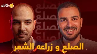 فارماستان - الصلع الوراثي و زراعة الشعر