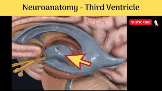 Third Ventricle | Extent | Boundaries | Recesses | Tela choroidea | Clinical correlation