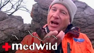 Wilderness Medicine: Altitude Illness - Diamox (Acetazolamide)