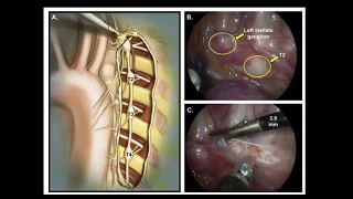 Guidelines for Ventricular Arrhythmia & Sudden Cardiac Death