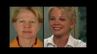 Dr. Peter Newen - Becky Facelift Video Diary