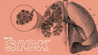 Here's Why Pneumonia Is Still So Deadly