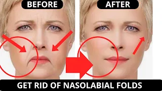 🛑 FACIAL EXERCISES FOR NASOLABIAL FOLDS (LAUGH LINES) JOWLS, SAGGY SKIN, JAWLINE, TURKEY NECK