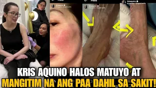 KRIS AQUINO HALOS MATUYO AT MANGITIM ANG MGA PAA DAHIL SA SAKIT NITO❤️Makakabalik na ng Pinas!