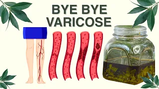 Say goodbye to varicose veins and joint pain with bay leaf! 💥