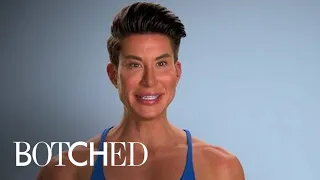 Human Ken Doll Is BACK With MORE Implants | Botched | E!