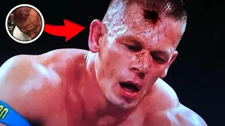 5 Times WWE Wrestlers Got Dangerously Busted Open For Real