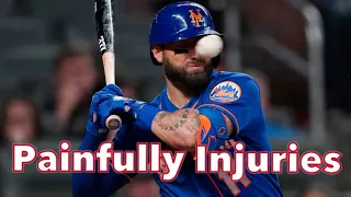 MLB  Face Injuries