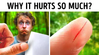 Why Paper Cuts Are So Painful (And Other Surprising Facts)