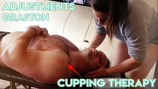 CUPPING THERAPY, GRASTON, & CHIRO ADJUSTMENTS FOR SHOULDER PAIN