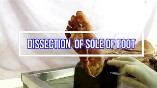 Dissection  of Sole of Foot