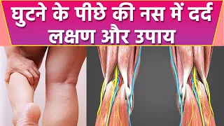 घुटने के पीछे की नस में दर्द क्यों होता हैं । घुटने के पीछे की नस में दर्द के उपाय । Boldsky *Health