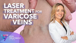 Medical Center: Laser Treatment for Varicose Veins | Spider and Varicose Vein Treatment Center