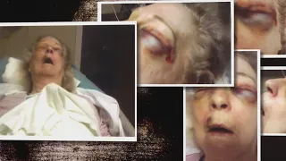 Years after woman was 'eaten alive' by mites, nursing home still receives neglect complaints