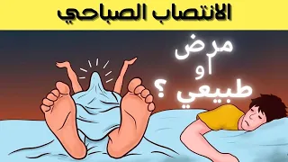 لماذا يصاب الشباب بالانتصاب الصباحي؟هل سمعت من قبل عن ظاهرة الانتصاب الصباحي؟