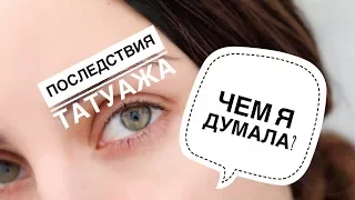 ПОСМОТРИ, ПРЕЖДЕ ЧЕМ ДЕЛАТЬ | УЖАСЫ ТАТУАЖА | УДАЛЕНИЕ