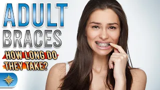 Adult Braces: How Long Do They Take?