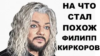 ФИЛИПП КИРКОРОВ после пластических операций.