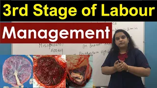 Management of Third Stage of Labour | Normal Labour | Nursing Lecture