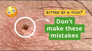 The Top 4 Tick Mistakes You Don't Want to Make