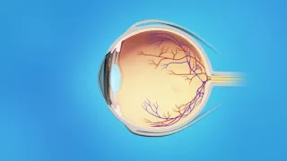 Wet AMD Medication Injections