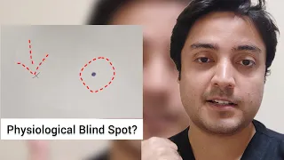 Physiological Blind Spot | Cause Explained 👁️