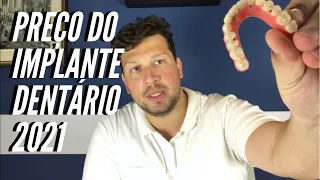 Preço do implante dentário