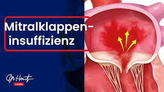 Mitralklappeninsuffizienz - einfach erklärt! | Dr.Heart