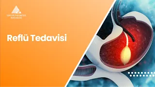 Reflü Tedavisi | Prof. Dr. Cengiz Pata