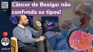 Câncer de Bexiga: Você sabe as diferenças entre os tipos?