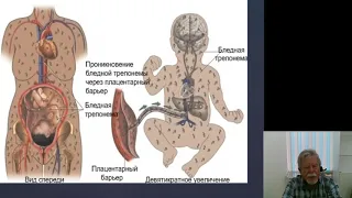 Дерматовенерология 3.Врожденный сифилис