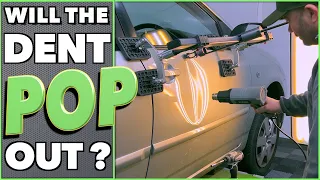 PDR Technician Shows YOU How To Fix A Dent Without Paint | Dent-Remover