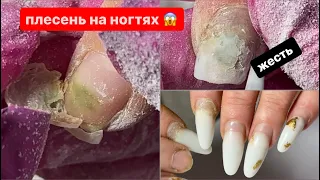 ПЛЕСЕНЬ на ногтях⁉️Покрывать или нет ?2️⃣месяца ногтям