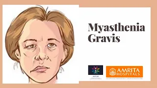 Myasthenia Gravis || Crisis