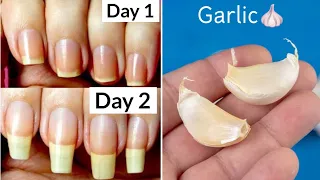 How to Grow Nails in 2 Days || How to Grow Nails Fast || @jyoticachauhan
