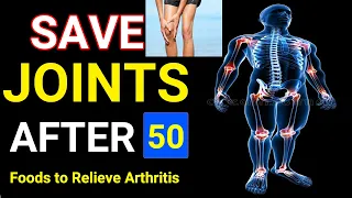 These Foods Improve Joints Health and Relieve Arthritis Pain at 50 Years of Age (Better to Know)