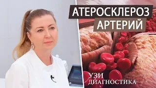 Атеросклероз артерий. УЗИ диагностика сосудов