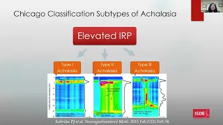 Update on pathophysiology and work up for Achalasia